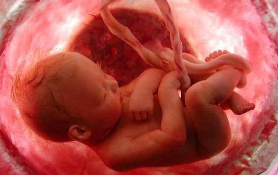 muñeco con cordon umbilical